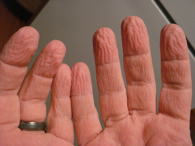 WetWrinkles
